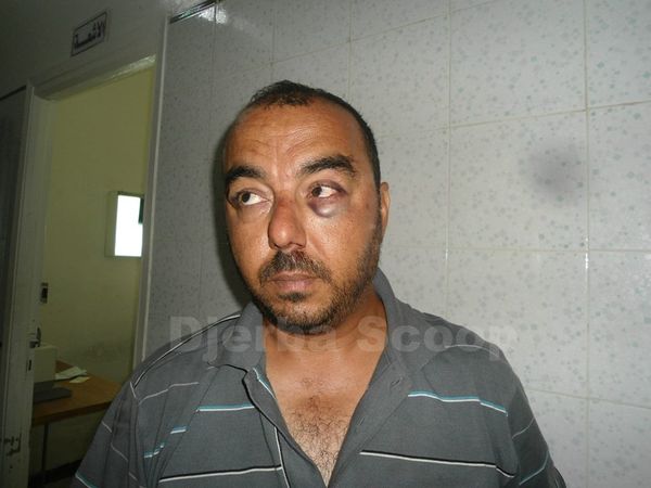 قلالة : الأمن يعتدى على أحد صحفيين بالماتراك والرّكل