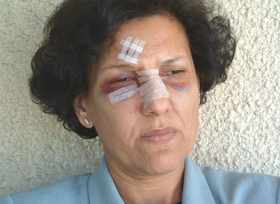 المحامية راضية النصراوي مرشحة لنيل جائزة نوبل للسلام: تاريخ من النضال يستحق التتويج