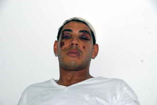 Tunisie: Le président de l'ANC au chevet des policiers blessés